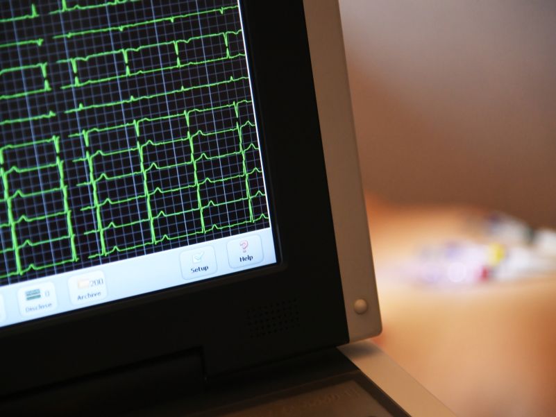 ECG CLOSE