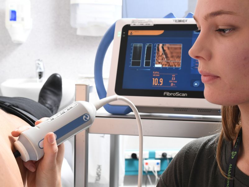 Fibroscan 2
